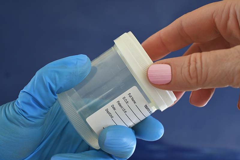 Specimen Sample Cup Specimen Sample Cup